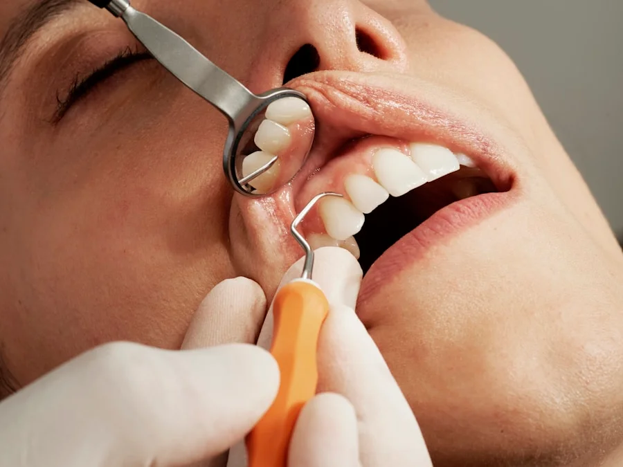 Dental consultation for wisdom tooth assessment